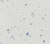 ASD 1050 ÀÍÄÐÎÌÅÄÀ ÁÅËÛÉ (P/LPC)